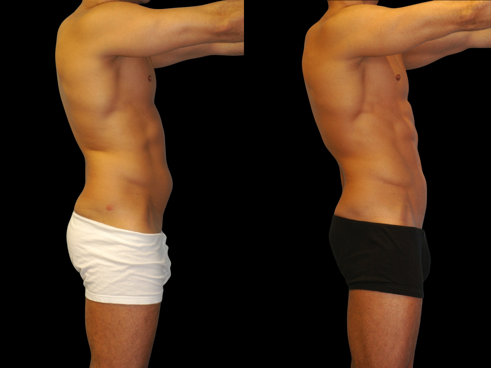the-etch-dr-soler-baillo-miami-plastic-surgery-01a