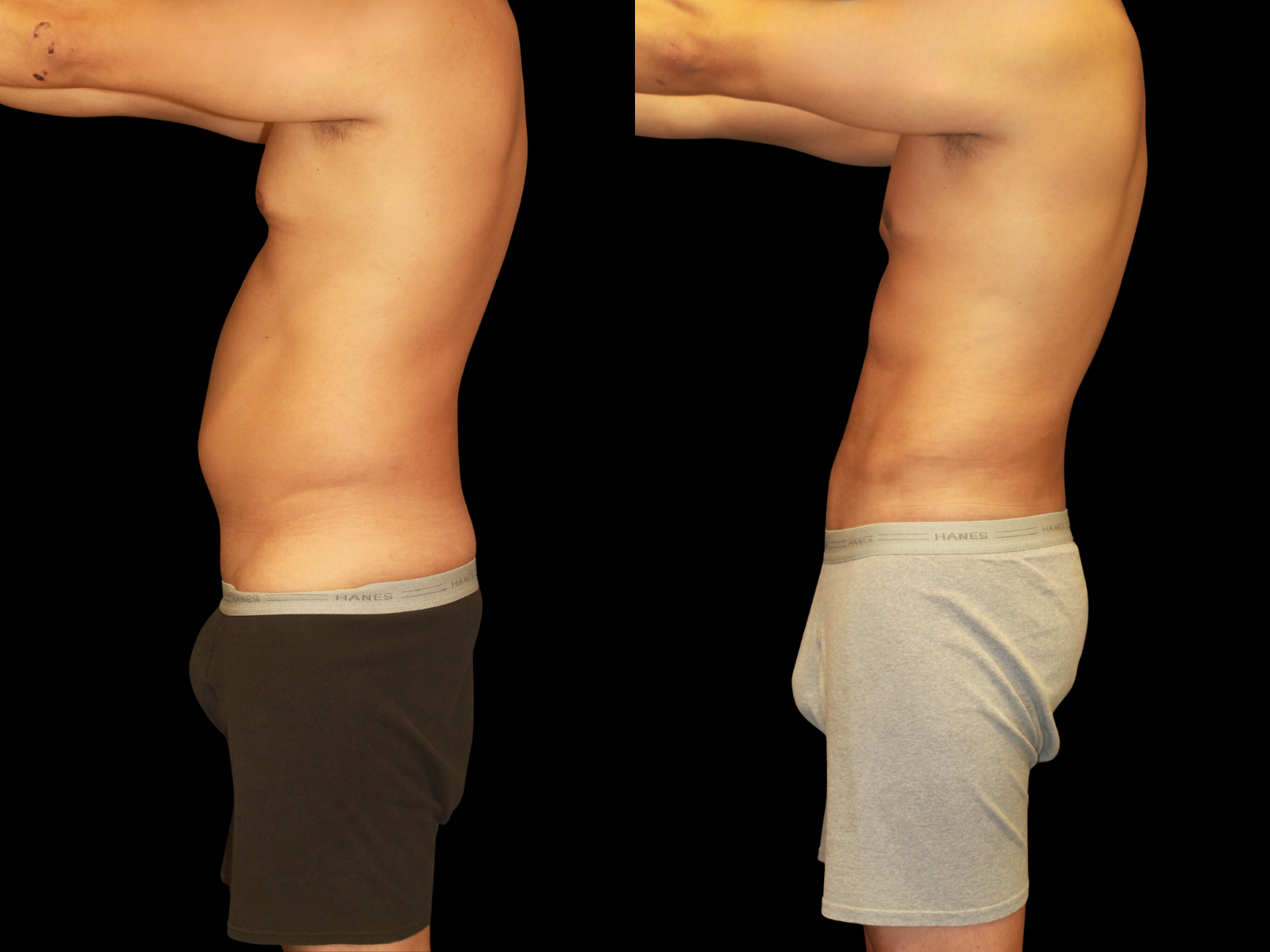 the-etch-dr-soler-baillo-miami-plastic-surgery-02b